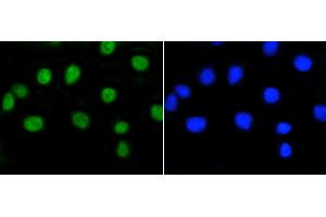 Immunofluorescence (Cultured Cells) (IF (cc)) image for anti-Retinoblastoma 1 (RB1) (pSer807) antibody (ABIN5557520)