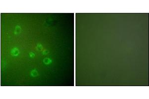 Immunofluorescence analysis of COS7 cells, using GRP78 antibody. (GRP78 抗体)