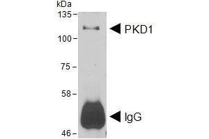 HEK293 lysate overexpressing Human DYKDDDDK-tagged PKD1 was used to immunoprecipitate PKD1 with 2ug ABIN4902745. (PKC mu 抗体)
