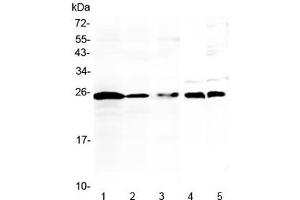 Western blot testing of 1) human Jurkat, 2) human K562, 3) human Raji, 4) rat thymus and 5) mouse thymus lysate with IL-36 alpha antibody at 0. (IL36A/IL1F6 抗体)