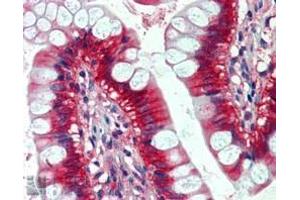 ABIN302138 (2. (GTPase NRas 抗体  (Internal Region))