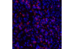 Immunofluorescence (IF) image for anti-CD8a Molecule (CD8A) (AA 185-235) antibody (ABIN7449561) (Recombinant CD8 alpha 抗体  (AA 185-235))