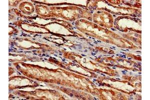 Immunohistochemistry of paraffin-embedded human kidney tissue using ABIN7142512 at dilution of 1:100 (RPS2 抗体  (AA 2-61))