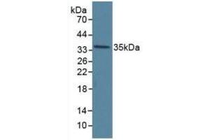 Detection of ANXA5 in Human Hela Cells using Polyclonal Antibody to Annexin V (ANXA5) (Annexin V 抗体  (AA 1-320))