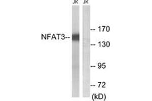 Western blot analysis of extracts from Jurkat cells, using NFAT3 (Ab-168/170) Antibody. (NFATC4 抗体  (AA 136-185))