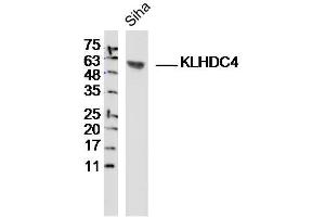 Siha lysates probed with KLHDC4 Polyclonal Antibody, Unconjugated  at 1:300 dilution and 4˚C overnight incubation. (KLHDC4 抗体  (AA 201-300))