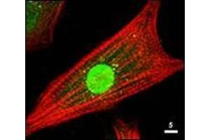 Immunofluorescence Microscopy: Rabbit anti-AKT antibody was used at a 1/80 dilution to stain cultured neonatal Rat cardiomyocytes that express a nuclear-targeted AKT construct. (AKT1 抗体  (C-Term))