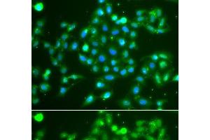 Immunofluorescence analysis of A549 cells using UCHL5 Polyclonal Antibody (UCHL5 抗体)