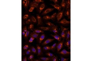 Immunofluorescence analysis of U-2 OS cells using BFAR Polyclonal Antibody (ABIN6127492, ABIN6137542, ABIN6137543 and ABIN6224322) at dilution of 1:100 (40x lens). (BFAR 抗体  (AA 1-140))