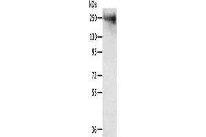 Gel: 6 % SDS-PAGE, Lysate: 40 μg, Lane: Mouse muscle tissue, Primary antibody: ABIN7192726(TACC2 Antibody) at dilution 1/300, Secondary antibody: Goat anti rabbit IgG at 1/8000 dilution, Exposure time: 5 minutes (TACC2 抗体)