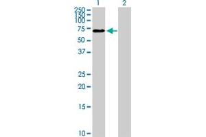 Western Blot analysis of ZNHIT6 expression in transfected 293T cell line by ZNHIT6 MaxPab polyclonal antibody. (ZNHIT6 抗体  (AA 1-470))