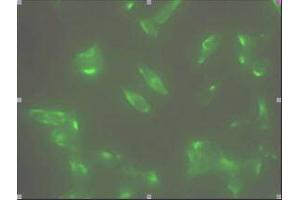Immunofluorescence staining of human LNCap cell colony with monoclonal anti- human STEAP1 antibody (J2D2) (STEAP1 抗体  (AA 1-70))