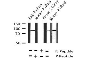 Western Blotting (WB) image for anti-Cortactin (CTTN) (pTyr466) antibody (ABIN6256746)