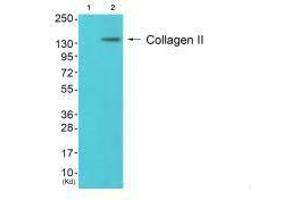 Western blot analysis of extracts from 3T3 cells (Lane 2), using Collagen II antiobdy. (COL2A1 抗体)