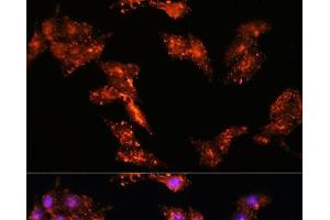 Immunofluorescence analysis of HeLa cells using CDK5RAP1 Polyclonal Antibody at dilution of 1:100.