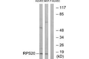 Western blot analysis of extracts from HuvEc/MCF-7 cells, using RPS20 Antibody. (RPS20 抗体  (AA 31-80))