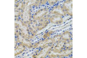 Immunohistochemistry of paraffin-embedded rat kidney using PCSK9 antibody (ABIN5975791) at dilution of 1/100 (40x lens).
