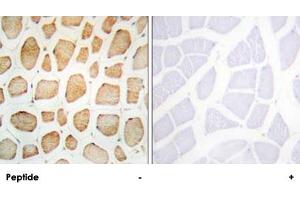 Immunohistochemistry analysis of paraffin-embedded human skeletal muscle tissue using ACTN2/ACTN3 polyclonal antibody . (ACTN2 抗体  (N-Term))