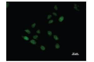 Immunostaining analysis in HeLa cells. (BTAF1 抗体)