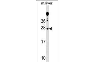 TRAT1 Antibody (Center) (ABIN1538723 and ABIN2848787) western blot analysis in mouse liver tissue lysates (35 μg/lane). (TRIM 抗体  (AA 98-127))