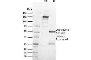 SDS-PAGE Analysis Purified CD61 Mouse Monoclonal Antibody (ITGB3/2597). (Integrin beta 3 抗体  (AA 385-490))