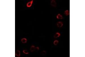 Immunofluorescent analysis of CDKN3 staining in MCF7 cells. (CDKN3 抗体)