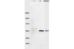 Lane 1: mouse lung lysates Lane 2: mouse brain lysates probed with Anti phospho-MAPKAPK5(Thr182) Polyclonal Antibody, Unconjugated (ABIN710546) at 1:200 in 4 °C. (MAPKAP Kinase 5 抗体  (pThr182))