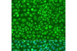 Immunofluorescence analysis of U2OS cells using DNAL1 Polyclonal Antibody at dilution of 1:100. (DNAL1 抗体)