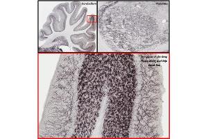 Adult rat cerebellum and thalamus immunohistochemistry.