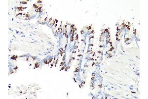 Immunohistochemistry of paraffin-embedded rat bronchial epithelium using PDCD1 antibody (ABIN6290170) at dilution of 1:100 (40x lens). (PD-1 抗体)