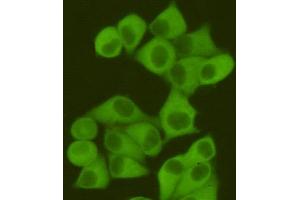 Immunocytochemistry staining of Hela cells fixed with 4 % Paraformaldehyde and using anti-Fatty Acid Synthase mouse mAb (dilution 1:400). (Fatty Acid Synthase 抗体)