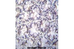 TBCA Antibody (Center) immunohistochemistry analysis in formalin fixed and paraffin embedded human rectum tissue followed by peroxidase conjugation of the secondary antibody and DAB staining. (TBCA 抗体  (Middle Region))