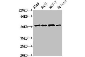 Western Blot Positive WB detected in: A549 whole cell lysate, Raji whole cell lysate, MCF-7 whole cell lysate, Rat spleen tissue All lanes: SERPINC1 antibody at 2. (SERPINC1 抗体  (AA 37-180))