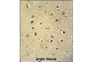 Immunohistochemistry (IHC) image for anti-gamma-aminobutyric Acid (GABA) A Receptor, gamma 2 (GABRG2) (AA 198-224) antibody (ABIN5536152)