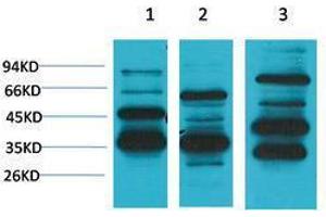 Western Blotting (WB) image for anti-MAS1 Oncogene (MAS1) antibody (ABIN3179049) (MAS1 抗体)