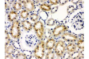 Immunohistochemistry (Paraffin-embedded Sections) (IHC (p)) image for anti-Keratin 19 (KRT19) (AA 334-372), (C-Term) antibody (ABIN3043288)