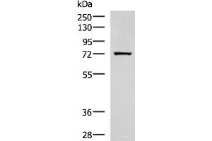 Western blot analysis of Human fetal liver tissue lysate using SHTN1 Polyclonal Antibody at dilution of 1:600 (Shootin-1 (SHTN1) 抗体)