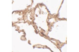 Immunohistochemistry (IHC) image for anti-Arylsulfatase B (ARSB) (C-Term) antibody (ABIN2457880) (Arylsulfatase B 抗体  (C-Term))