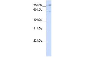 DLG7 antibody used at 1 ug/ml to detect target protein. (DLGAP5 抗体  (N-Term))