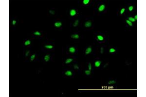 Immunofluorescence of purified MaxPab antibody to CENPH on HeLa cell. (CENPH 抗体  (AA 1-247))