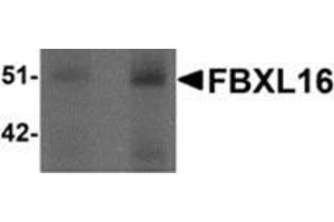 Western blot analysis of FBXL16 in human spleen tissue lysate with FBXL16 antibody at (left) 0. (FBXL16 抗体  (C-Term))