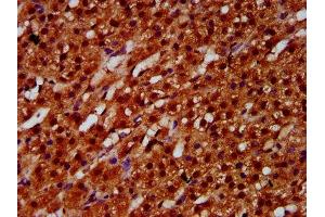 IHC image of ABIN7152082 diluted at 1:600 and staining in paraffin-embedded human adrenal gland tissue performed on a Leica BondTM system. (ETV5 抗体  (AA 124-265))