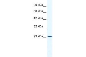 Western Blotting (WB) image for anti-Potassium Channel Tetramerisation Domain Containing 11 (KCTD11) antibody (ABIN2461421) (KCTD11 抗体)