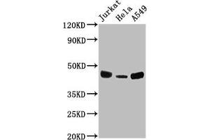 Western Blot Positive WB detected in: Jurkat whole cell lysate, Hela whole cell lysate, A549 whole cell lysate All lanes: HLA-C antibody at 1:2000 Secondary Goat polyclonal to rabbit IgG at 1/50000 dilution Predicted band size: 41 kDa Observed band size: 41 kDa