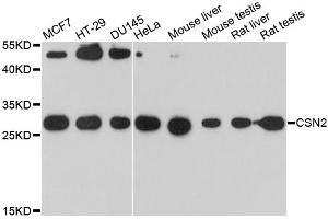 Western blot analysis of extracts of various cell lines, using CSN2 antibody. (CSN2 抗体)