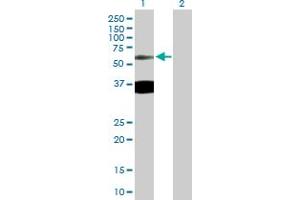 Western Blot analysis of TTBK2 expression in transfected 293T cell line by TTBK2 MaxPab polyclonal antibody. (TTBK2 抗体  (AA 1-478))