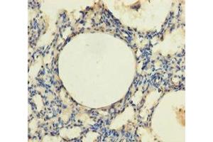 Immunohistochemistry of paraffin-embedded human lung tissue using ABIN7172870 at dilution of 1:100 (TRPM8 抗体  (AA 1-192))