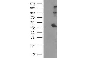 Western Blotting (WB) image for anti-Aryl Hydrocarbon Receptor Interacting Protein-Like 1 (AIPL1) antibody (ABIN1496509) (AIPL1 抗体)