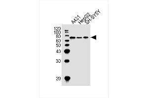 Lane 1: A431 Cell lysates, Lane 2: HepG2 Cell lysates, Lane 3: SH-SY5Y Cell lysates, probed with EIF2AK2 (1441CT628. (EIF2AK2 抗体)