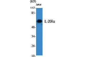 Western Blot (WB) analysis of specific cells using IL-20Ralpha Polyclonal Antibody.